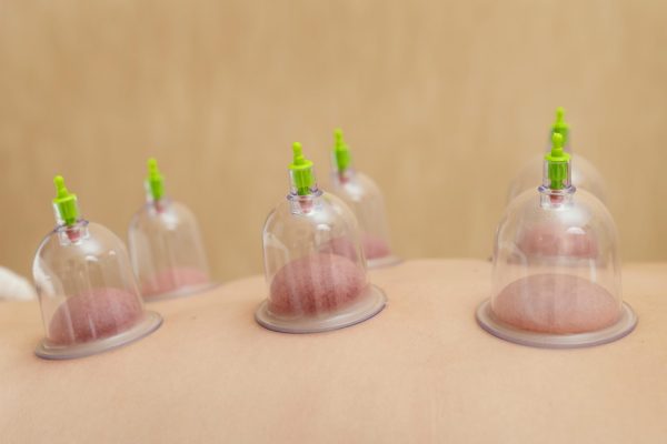 حجامة أبوظبي , Hijama , Cupping