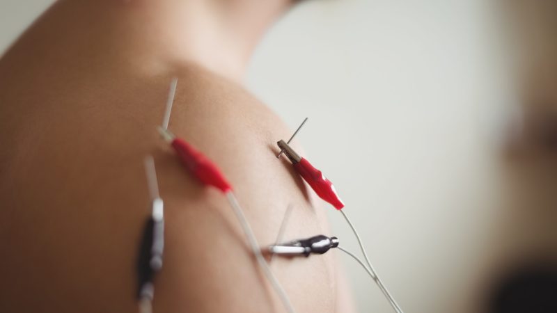 Hijama , Acupuncture , ابر صينية مجموعة الرحمة الطبية Al Rahma Medical Group